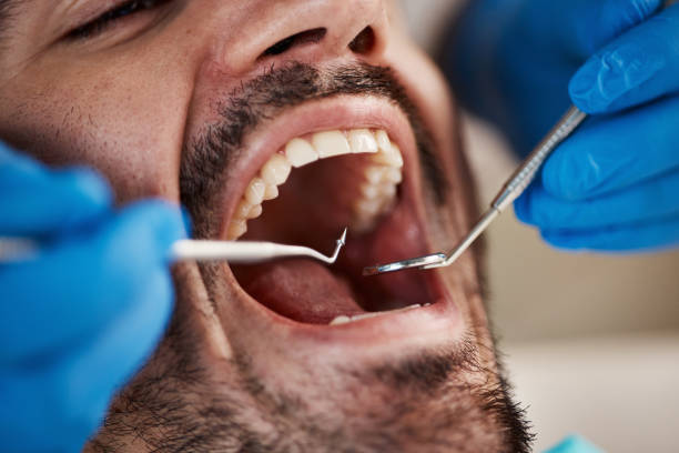 Best Emergency Care for Gum Disease in Glade Spring, VA